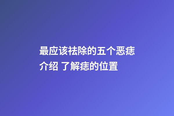 最应该祛除的五个恶痣介绍 了解痣的位置